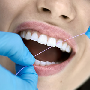 Dental hygienist flossing patient's teeth