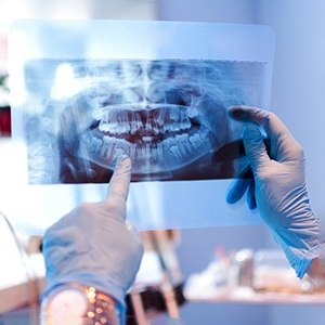 Dentist with blue gloves holding up patient's X-ray