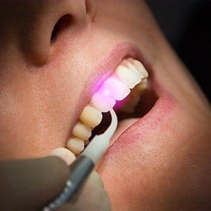 Patient receiving laser dentistry