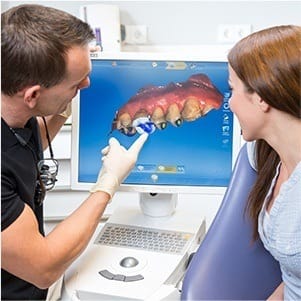 CEREC digital bite impressions