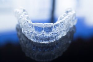 Invisalign in Naples